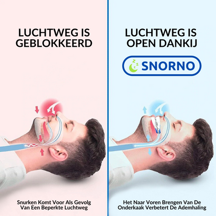 Hoogwaardige Anti-Snurk Mondstuk | Snurkpreventie & Optimale Ademhaling | Comfortabel & Hypoallergeen | Ideaal Voor Thuis & Reis | Duurzaam & Herbruikbaar | Persoonlijke Verzorging | Zorg Voor Een Goede Nachtrust